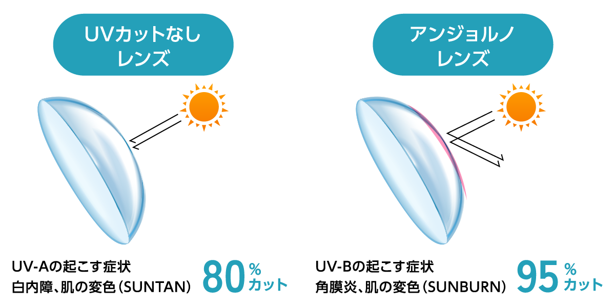 アンジョルノレンズ UV-Bの起こす症状角膜炎、肌の変色(SUNBURN)95%カット